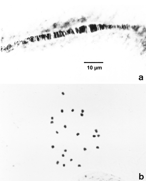 Picture of Phaseolus polytene and mitotic metaphase chromosomes
