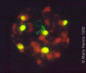 Interphase nucleus with hybridization signals of FISH with 18S-25S rDNA probe on Phaseolus polytene chromosomes