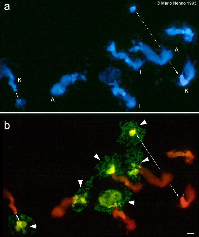 Nucleus with hybridization signals of FISH with 18S-25S rDNA probe on Phaseolus polytene chromosomes