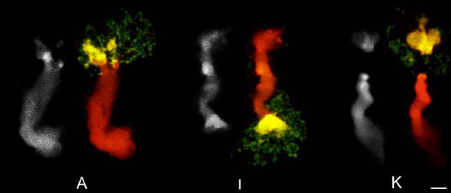 Hybridization signals of FISH with 18S-25S rDNA probe on 3 Phaseolus polytene chromosomes