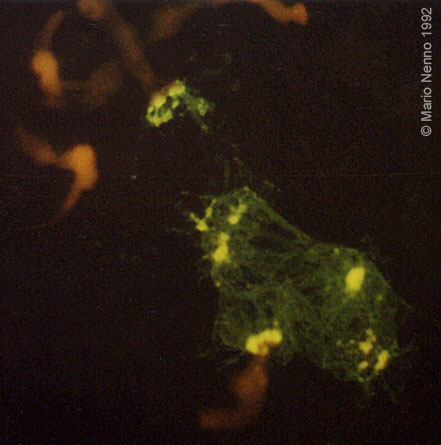 Direct detection of 18S-25S rDNA with FITC-dUTP of Phaseolus polytene chromosomes by FISH