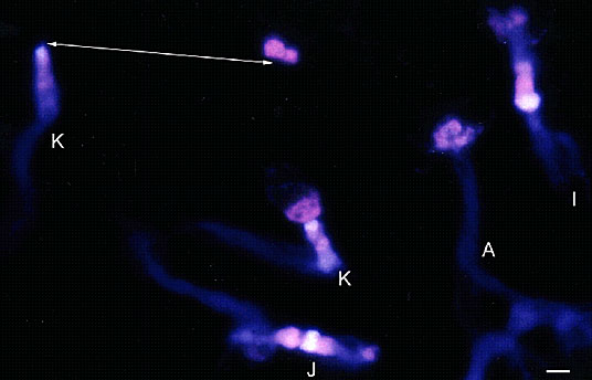 Fluorochrome banding (DAPI/PIC) of Phaseolus polytene chromosomes