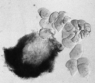 Riesenchromosomen2