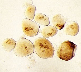 Riesenchromosomen3