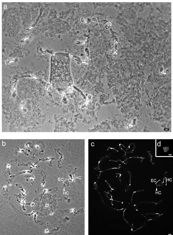 Euchromatin und Heterochromatin von Phaseolus Polytänchromosomen