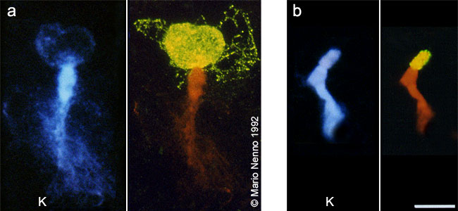 Condenzation of chromatin and FISH signal shape of 18S-25S rDNA probe on Phaseolus polytene chromosomes